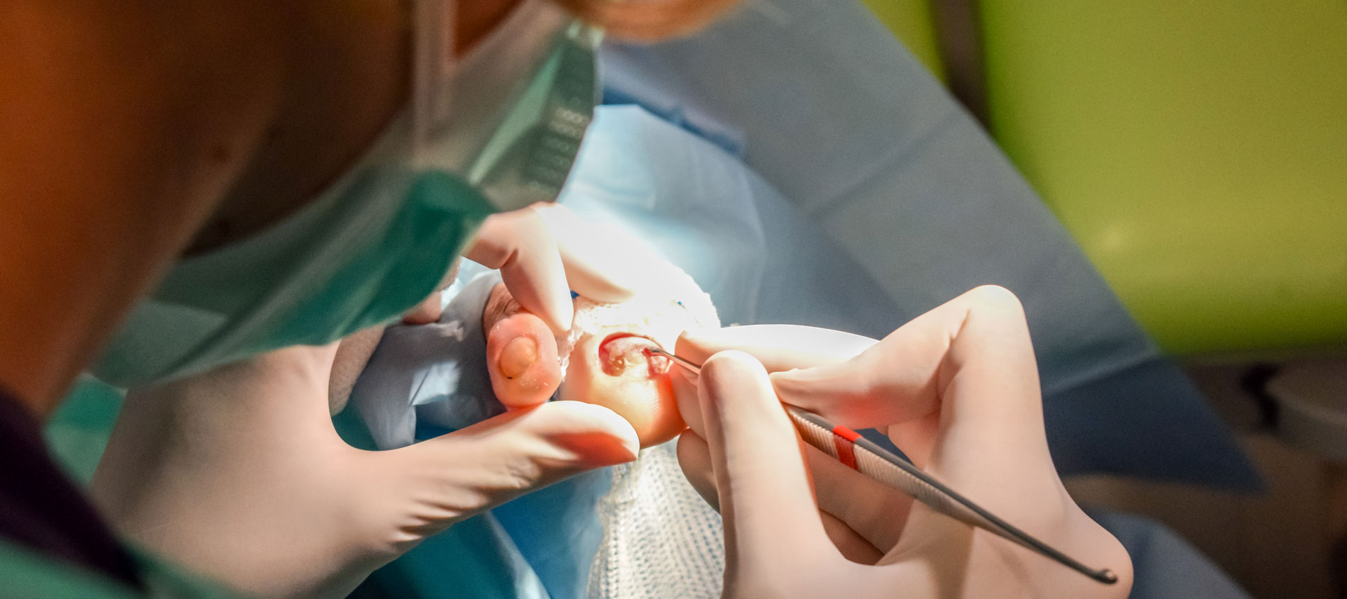 Cirugía del pie: Mejorando la salud